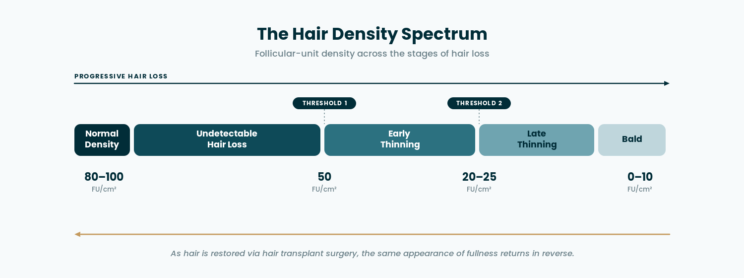 Hair density spectrum — follicular-unit density across the stages of hair loss
